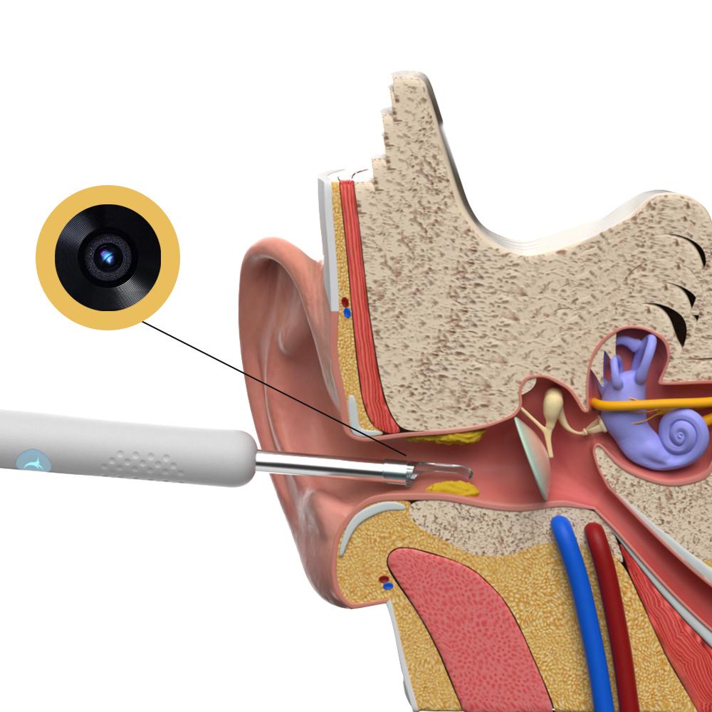OEM Bebird R1 Wifi earwax removal smart earpick cleaner with 3 megapixels HD 1080P camera kit - Image 4
